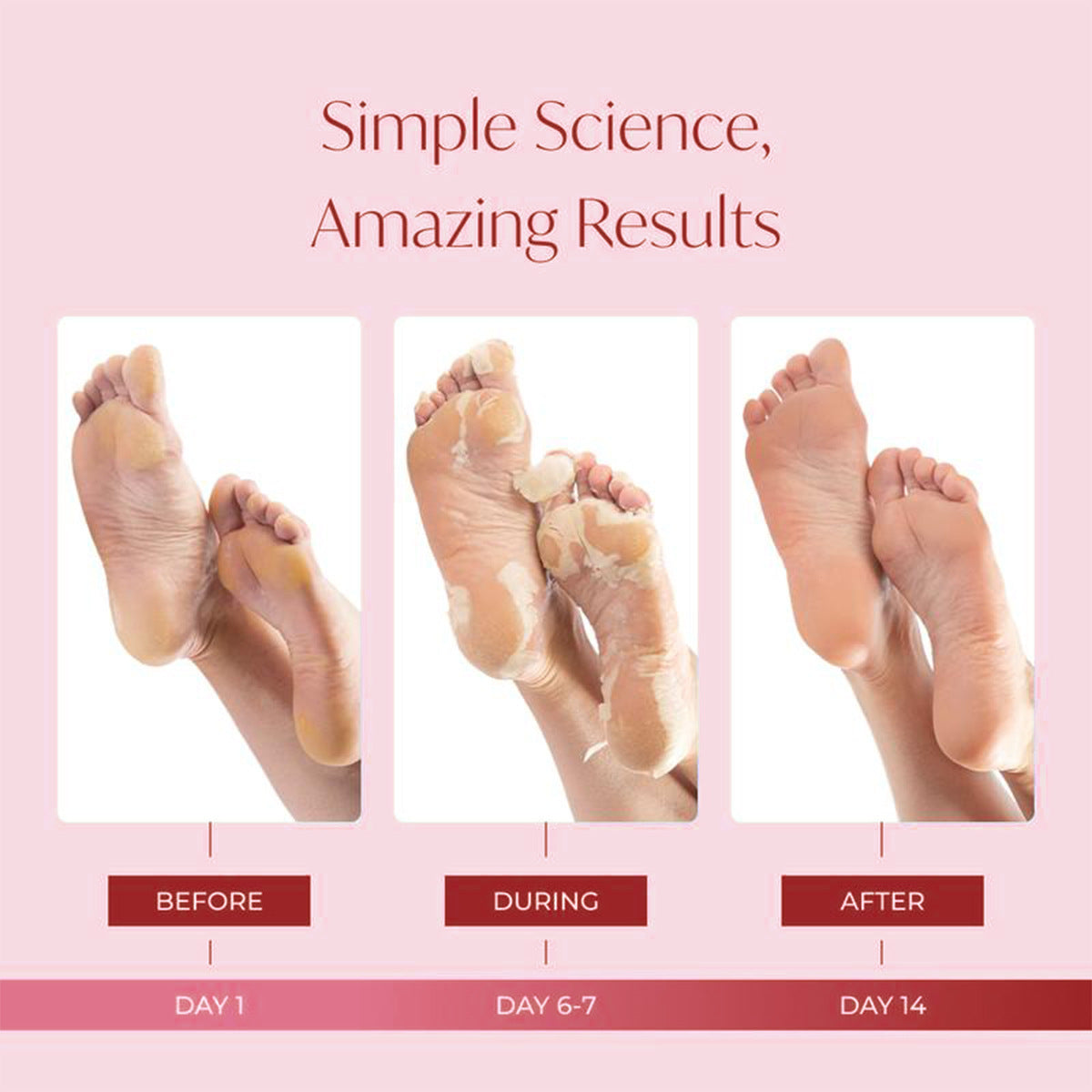 Foot exfoliating mask removes dead skin and calluses – revitalizes skin